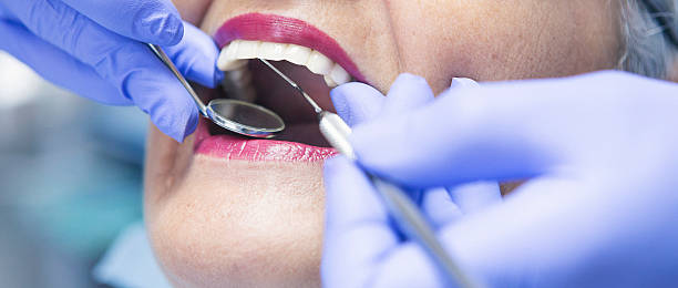 Best Emergency Dental Extractions in Madison, IL